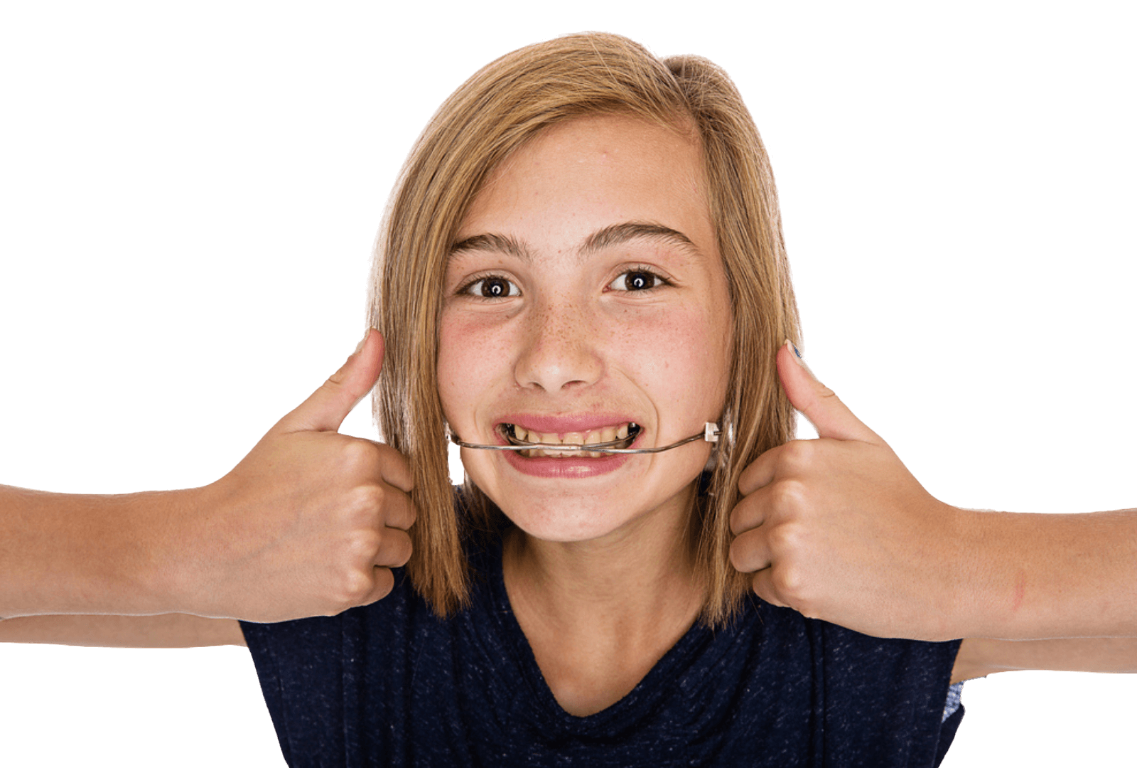 Smiling young person with straight, shoulder-length hair wearing orthodontic headgear and giving two thumbs up against a plain white background.