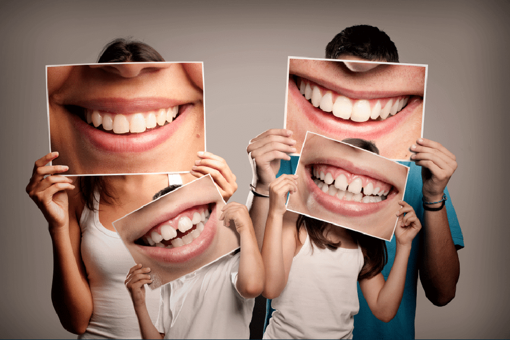 Four people hold photos of large smiling mouths in front of their faces, obscuring their actual faces and creating a playful, exaggerated effect.