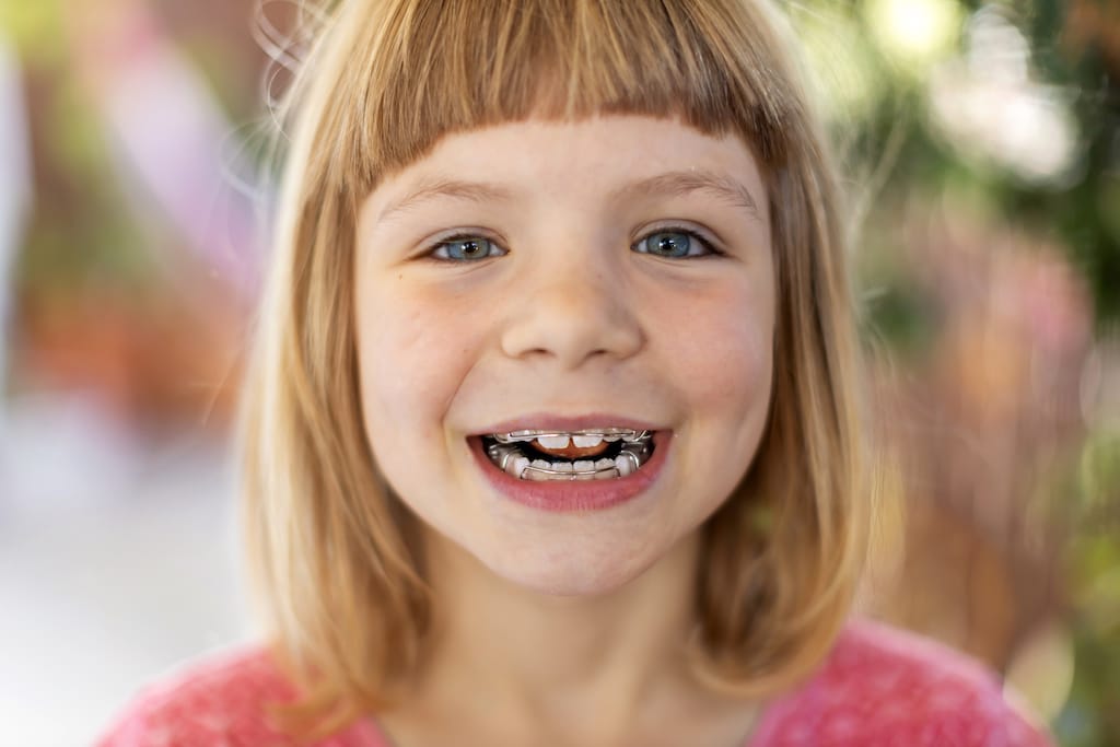 A young child with blonde hair and blue eyes smiles, showing a dental retainer on their teeth.