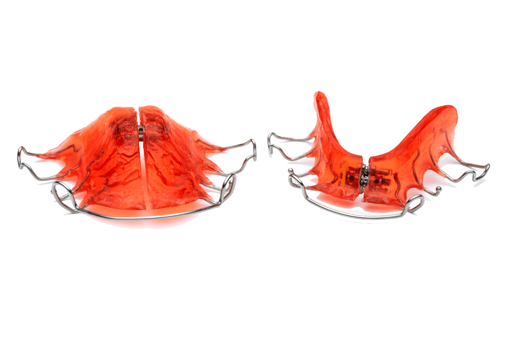 Two red orthodontic retainers with metal wires are displayed on a white background.