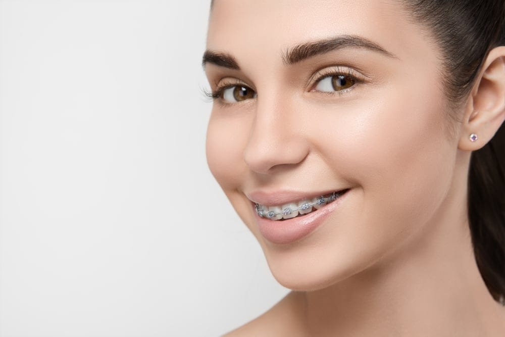 Close-up of a young woman smiling and wearing metal dental braces, with clear skin and straight dark hair, against a plain light background.