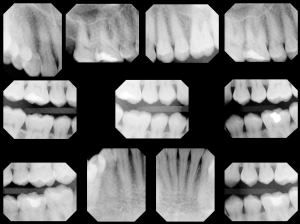 A set of ten dental X-rays showing close-up images of teeth and roots from different angles for diagnostic purposes.